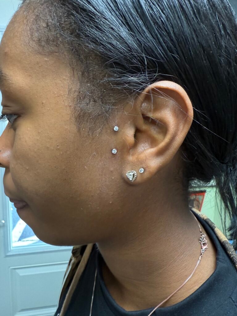A photograph of a woman with a freshly done surface tragus piercing. While not the most popular of piercings it leaves a very feminine look for women. And also a strong statement for men. The jewelry used was made of titanium and has CZ topper jewels. This piercing was done by Hope Boyd the body piercer at Near Me Tattoo at 6721 Bells Ferry Rd STE D110 Woodstock, Georgia 30189